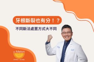 牙根斷裂也有分！？不同斷法處置方式大不同